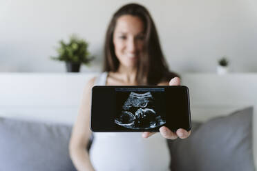 Frau zeigt Ultraschalluntersuchung durch Mobiltelefon zu Hause - EBBF05220