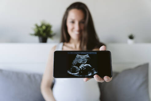 Woman showing ultrasound scan through mobile phone at home - EBBF05220