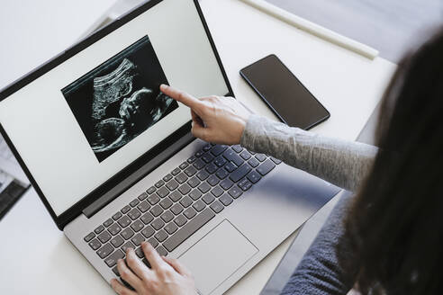 Schwangere Frau berührt Ultraschallbild auf Laptop-Bildschirm zu Hause - EBBF05644
