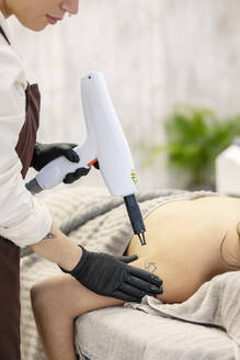 Therapeut entfernt Tätowierung von der Schulter einer Frau mit medizinischem Laser - MTBF01178