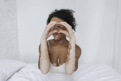 Smiling woman with vitiligo gesturing heart shape sitting on bed at home - SIF00027