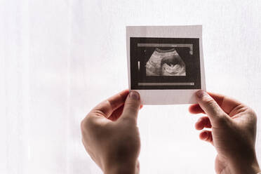 Woman's hands holding an ultrasound of her baby. - CAVF95486