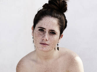 Girl with freckles on face and body - CAVF95561