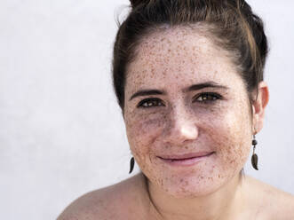 Pretty girl with freckles smiling - CAVF95562