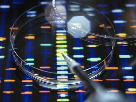 Pipettieren der Probe in die Schale für den DNA-Test mit Profil im Hintergrund - ABRF00953