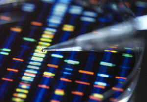 Pipettieren der Probe in die Schale für den DNA-Test - ABRF00957