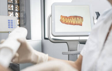 Dentist working by scanned image of teeth on monitor screen at dental clinic - JCCMF05850