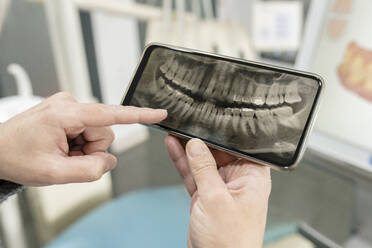 Zahnarzt, der ein Röntgenbild auf einem Mobiltelefon untersucht - JCCMF05853