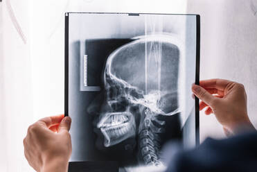 Doctor examining a head x-ray - CAVF95900