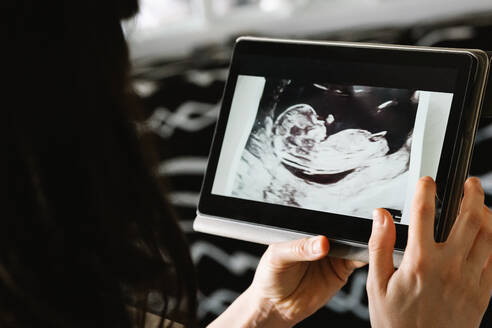 Von oben abgeschnitten unerkennbar schwangere Mutter Blick auf Ultraschall-Scan des ungeborenen Babys auf digitalem Tablet - ADSF34493