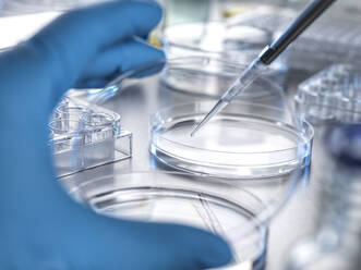 Hand eines Wissenschaftlers, der eine Lösung aus einer Pipette in eine Petrischale im Labor umfüllt - ABRF00971