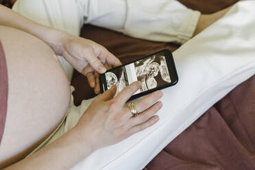 Schwangere Frau, die medizinische Röntgenaufnahmen auf einem Smartphone betrachtet - SEAF00985