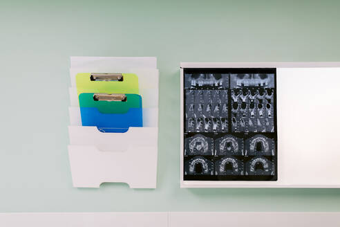 Verschiedene Klemmbretter in einem Ordnerregal neben einem Röntgenbild von Zähnen an einer Wand im Krankenhaus - ADSF38214