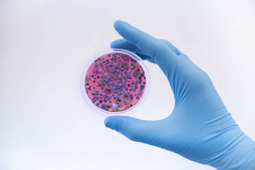 Wissenschaftlerin mit Schutzhandschuh hält Pilzkulturen in einer Petrischale - PCLF00030