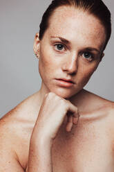 Portrait of woman with hand on chin. Close up of young woman with lots of freckles. - JLPSF06120