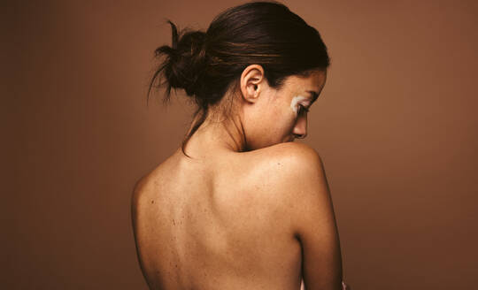 Rear view of woman with vitiligo standing against brown background. Woman having skin disease looking down. - JLPSF06147