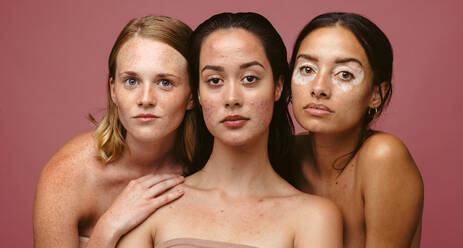 Multi-ethnic nude women posing together stock photo