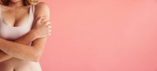 Abgeschnittene Aufnahme einer Frau mit Sommersprossen auf dem Körper vor einem pfirsichfarbenen Hintergrund. Nahaufnahme einer Frau mit Hautproblemen, die mit verschränkten Armen steht. - JLPSF06208