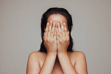 Frau mit Akneproblem, die ihr Gesicht mit ihren Händen versteckt. Frau, die sich aufgrund von Hautunreinheiten unsicher fühlt. - JLPSF06213