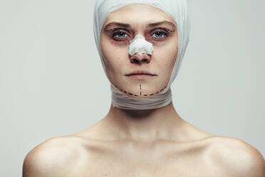 Close up of young woman wrapped in medical bandages after facial cosmetic surgery. Female model in bandage on grey background. - JLPSF20410