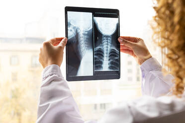 Anonymous ethnic female medic in uniform studying X ray image of spine on window in office - ADSF40150