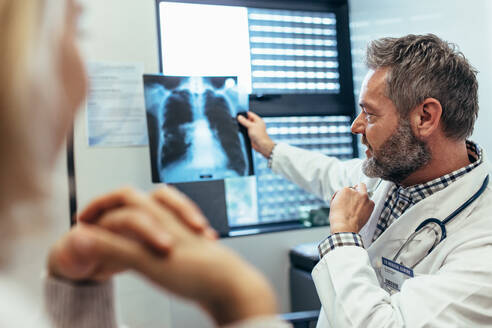 Ein Arzt bespricht die Untersuchungsergebnisse mit einem Patienten in der Klinik. Ein männlicher Radiologe untersucht die Thoraxaufnahme mit dem Patienten. - JLPSF27640