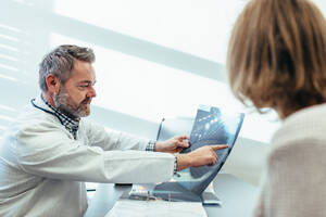Ein Arzt bespricht die Ergebnisse eines medizinischen Scans mit einem Patienten in seiner Klinik. Ein Mediziner zeigt einem Patienten in einer Arztpraxis ein Röntgenbild. - JLPSF27847