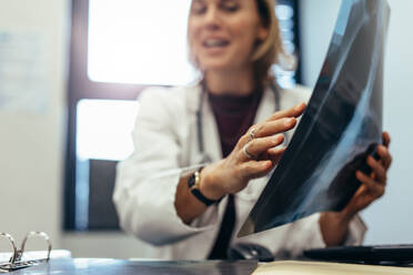 Ein Arzt erklärt einem Patienten in einer Klinik das Ergebnis eines medizinischen Scans. Ein Mediziner mit Röntgenbild bespricht die Diagnose. - JLPSF27885