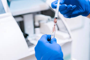 Hands of doctor analyzing blood sample at laboratory - MMPF00493