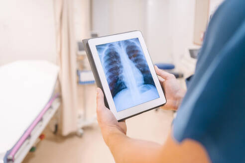 Hände eines Arztes, der einen Tablet-PC hält und ein Röntgenbild im Krankenhaus untersucht - MMPF00499
