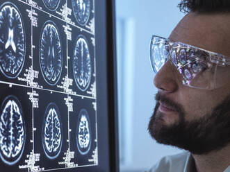 Arzt mit Bart bei der Untersuchung eines MRT-Gehirnscans - ABRF01025