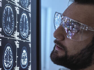 Doctor wearing eyeglasses analyzing brain scan - ABRF01027