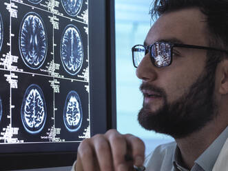 Arzt liest MRI-Gehirnscan auf dem Bildschirm - ABRF01028