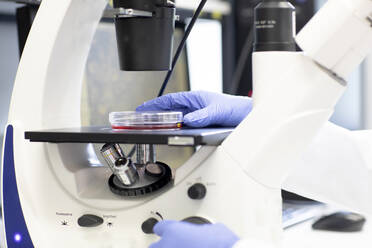 Wissenschaftlerin mit Petrischale, die eine medizinische Probe unter dem Mikroskop untersucht - SGF02937