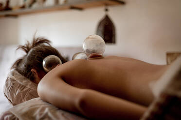 A relaxed young woman receiving cupping treatment on back, traditional chinese medicine. - HPIF03994