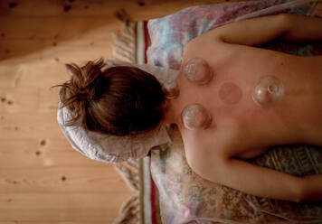 A high angle view of relaxed young woman receiving cupping treatment on back, traditional chinese medicine. - HPIF03996