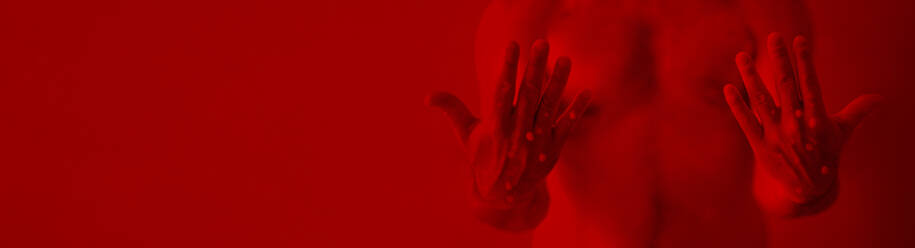 Eine männliche Hand mit blasenbildendem Ausschlag aufgrund einer Affenpockeninfektion auf rotem Hintergrund - HPIF04321