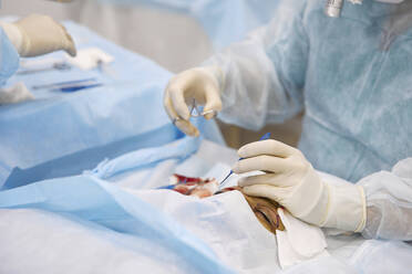 Arzt mit Werkzeugen bei einer Augenoperation an einem Patienten im Krankenhaus - SANF00023