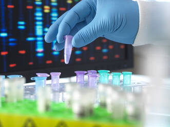 Hand eines Wissenschaftlers, der ein DNA-Probenröhrchen im Labor hält - ABRF01056