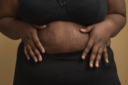 Hands of plus size woman touching belly with stretch marks against beige background - VRAF00084