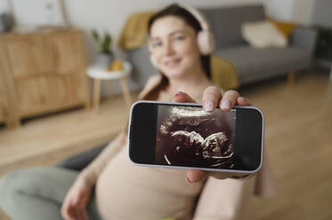 Schwangere Frau zeigt Ultraschallbild auf dem Bildschirm eines Smartphones - ALKF00222