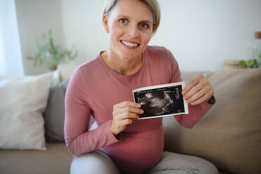 Schwangere Frau zeigt Ultraschallfoto eines Babys. - HPIF11635