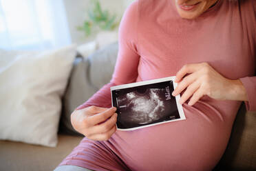 Schwangere Frau zeigt Ultraschallfoto eines Babys. - HPIF11682