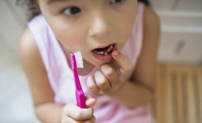 Obenansicht Porträt von besorgten kleinen Mädchen mit Zahnbürste drinnen, verlieren Baby Zahn. - HPIF15908