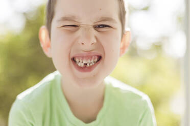 Cute boy showing gap tooth - ONAF00543