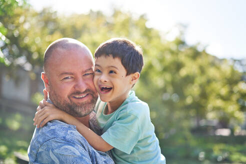 Portrait happy father holding cute son with Down Syndrome - CAIF33941