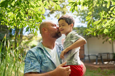 Father kissing happy, cute son with Down Syndrome in summer backyard - CAIF33965