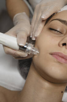 Hände eines Dermatologen, der eine Mikrodermabrasionsbehandlung auf dem Gesicht einer Frau durchführt - ALKF00620