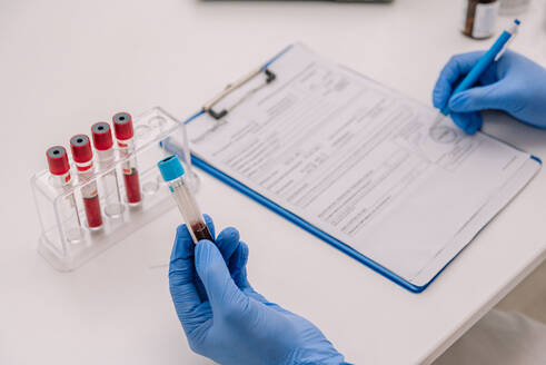 From above of crop unrecognizable in blue latex gloves filling out medical form after taking blood samples while sitting at table in laboratory - ADSF47725