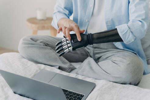 Handicapped woman works on laptop at home. Freelancer sets up bionic prosthesis. Disabled girl types on keyboard. - INGF12530